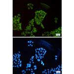SET Recombinant Rabbit Monoclonal Antibody (K01_1Y28)