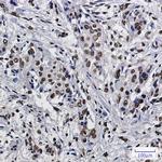 SET Antibody in Immunohistochemistry (Paraffin) (IHC (P))