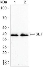 SET Antibody in Western Blot (WB)