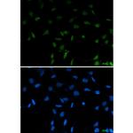 SFPQ Recombinant Rabbit Monoclonal Antibody (K01_1Y31)