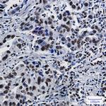 SFPQ Antibody in Immunohistochemistry (Paraffin) (IHC (P))