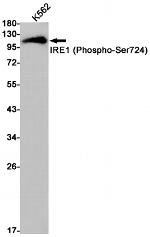 Phospho-IRE1 alpha (Ser724) Recombinant Rabbit Monoclonal Antibody (K01_1T04)