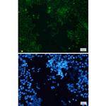 CYP17A1 Recombinant Rabbit Monoclonal Antibody (K01_1Q13)