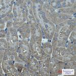 CYP17A1 Antibody in Immunohistochemistry (Paraffin) (IHC (P))