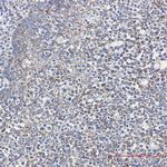 Cyclophilin F Antibody in Immunohistochemistry (Paraffin) (IHC (P))