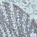 DNAJB6 Recombinant Rabbit Monoclonal Antibody (K01_1Q49)