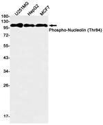 Phospho-Nucleolin (Thr84) Recombinant Rabbit Monoclonal Antibody (K01_1U95)