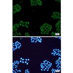 NR1D1 Recombinant Rabbit Monoclonal Antibody (K01_1U89)