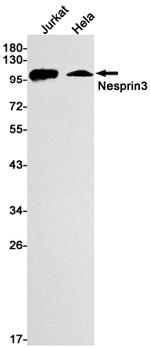 SYNE3 Recombinant Rabbit Monoclonal Antibody (K01_1U67)