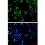 SP1 Recombinant Rabbit Monoclonal Antibody (K01_1Y66)