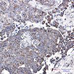 NDUFC2 Recombinant Rabbit Monoclonal Antibody (K01_1U56)