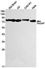 TAGAP Recombinant Rabbit Monoclonal Antibody (K01_2J02)