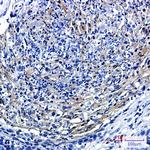 PRMT3 Antibody in Immunohistochemistry (Paraffin) (IHC (P))