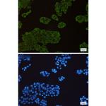 HSP90 Recombinant Rabbit Monoclonal Antibody (K01_1S60)