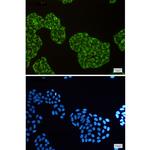 DISC1 Recombinant Rabbit Monoclonal Antibody (K01_1Q42)