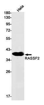 RASSF2 Recombinant Rabbit Monoclonal Antibody (K01_1X63)