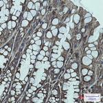 IGF2BP1 Recombinant Rabbit Monoclonal Antibody (K01_1S71)