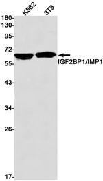 IGF2BP1 Antibody in Western Blot (WB)