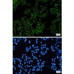 SGSM1 Recombinant Rabbit Monoclonal Antibody (K01_1Y33)