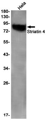 STRN4 Antibody in Western Blot (WB)