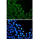 eIF4A3 Recombinant Rabbit Monoclonal Antibody (K01_1Q69)