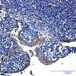 eIF4A3 Antibody in Immunohistochemistry (Paraffin) (IHC (P))