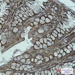 NDUFB11 Recombinant Rabbit Monoclonal Antibody (K01_1U52)