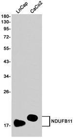 NDUFB11 Antibody in Western Blot (WB)
