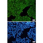 ENO3 Recombinant Rabbit Monoclonal Antibody (K01_1Q79)