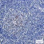 Relaxin 2 Recombinant Rabbit Monoclonal Antibody (K01_1X73)