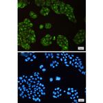 SCD Recombinant Rabbit Monoclonal Antibody (K01_1Y15)