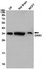 GNB3 Recombinant Rabbit Monoclonal Antibody (K01_1R86)