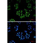 Fumarase Recombinant Rabbit Monoclonal Antibody (K01_1R16)