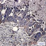 Fumarase Antibody in Immunohistochemistry (Paraffin) (IHC (P))