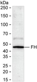 Fumarase Antibody in Western Blot (WB)