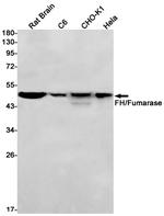 Fumarase Antibody in Western Blot (WB)