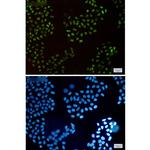 HLTF Recombinant Rabbit Monoclonal Antibody (K01_1S29)