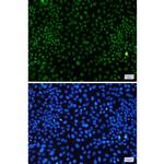 CDK9 Recombinant Rabbit Monoclonal Antibody (K01_1P40)