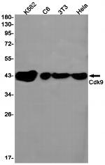 CDK9 Antibody in Western Blot (WB)