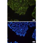 NFkB p100 Recombinant Rabbit Monoclonal Antibody (K01_1U76)