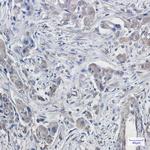 DTL Recombinant Rabbit Monoclonal Antibody (K01_1P44)