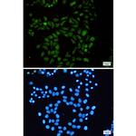 RAP1GAP Antibody in Immunocytochemistry (ICC/IF)