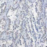RAP1GAP Antibody in Immunohistochemistry (Paraffin) (IHC (P))