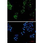S100A4 Recombinant Rabbit Monoclonal Antibody (K01_1Y02)