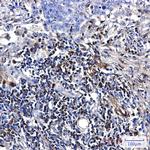 S100A4 Antibody in Immunohistochemistry (Paraffin) (IHC (P))