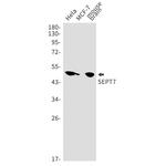 Septin-7 Recombinant Rabbit Monoclonal Antibody (K01_1Y25)