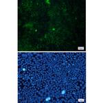 Cortactin Recombinant Rabbit Monoclonal Antibody (K01_1P72)