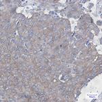 Cortactin Antibody in Immunohistochemistry (Paraffin) (IHC (P))