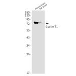 Cyclin T1 Antibody in Western Blot (WB)