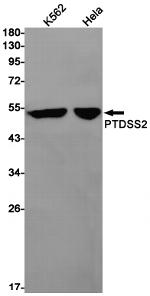 PTDSS2 Recombinant Rabbit Monoclonal Antibody (K01_1X30)